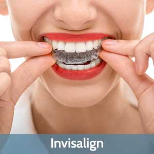 Invisalign in Omaha