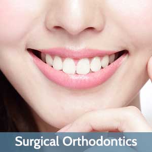 Surgical Orthodontics Central Omaha